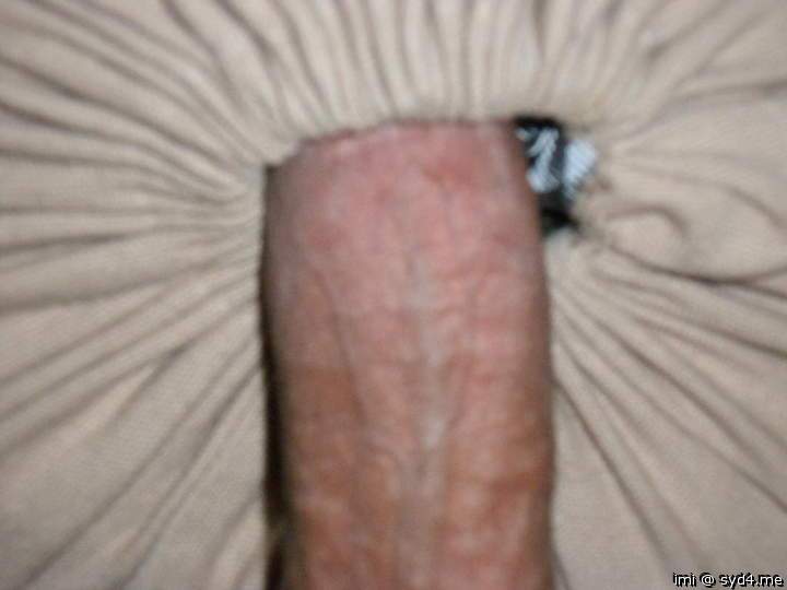 Photo of a penile from imi