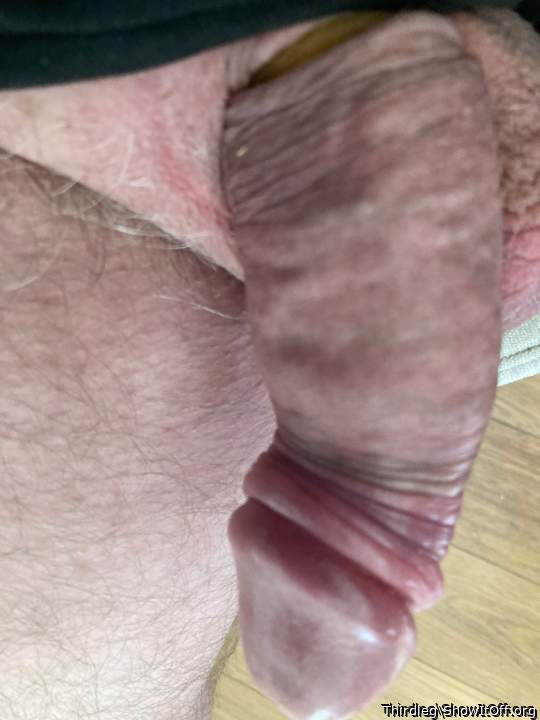 Photo of a penile from Thirdleg