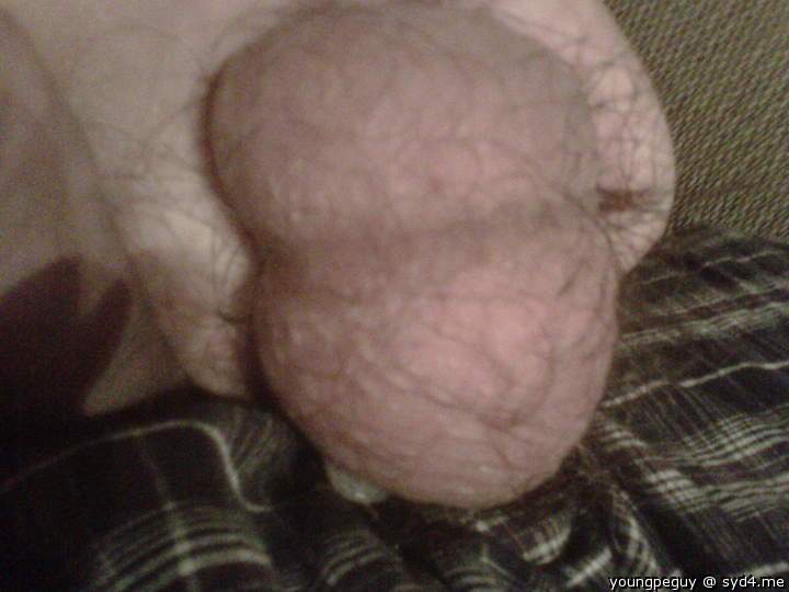 Testicles Photo from youngpeguy
