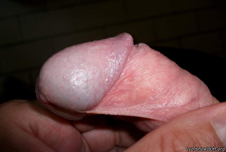 Glans sideview with corona, frenulum and retracted foreskin