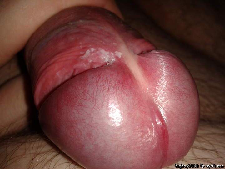 Photo of a penile from bigboy2008