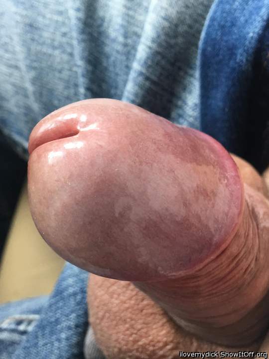 Photo of a penile from ilovemydick