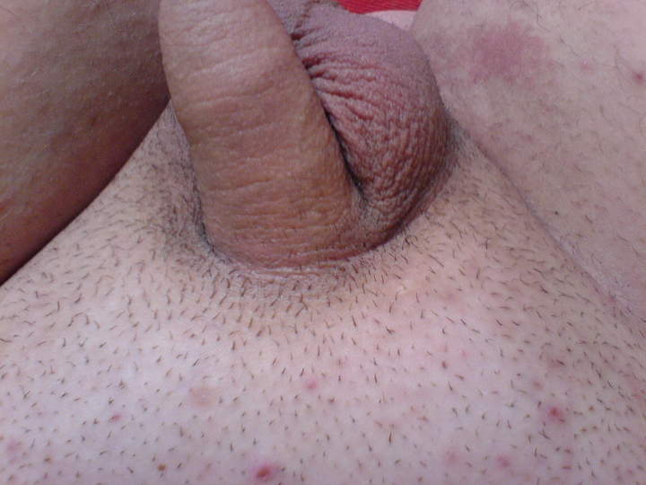 Photo of a penis from boy1987