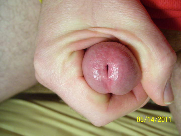 Photo of a private part from JUSTTOPLAY75