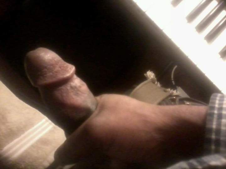 Photo of a penile from GaryMPLS72