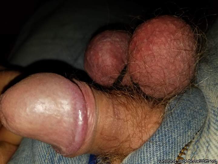 Photo of a penile from vanishing_Dick
