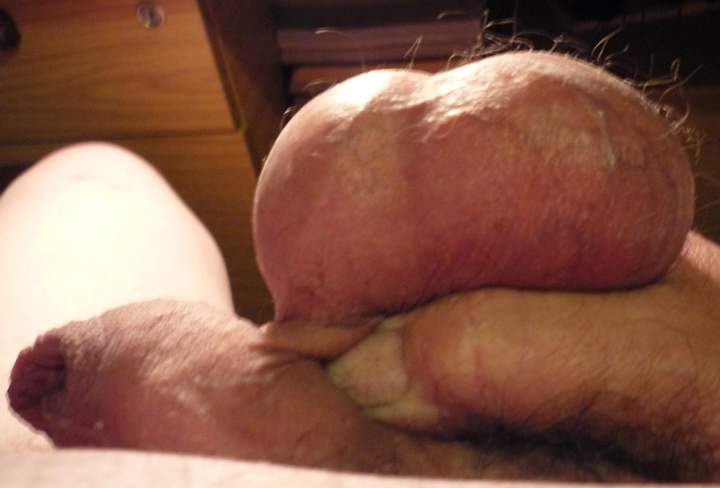 Testicles Photo from markcl