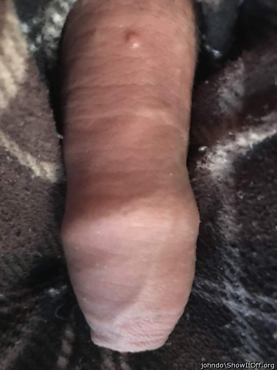 Photo of a short leg from johndo