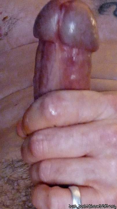 Photo of a penile from Just_Josh
