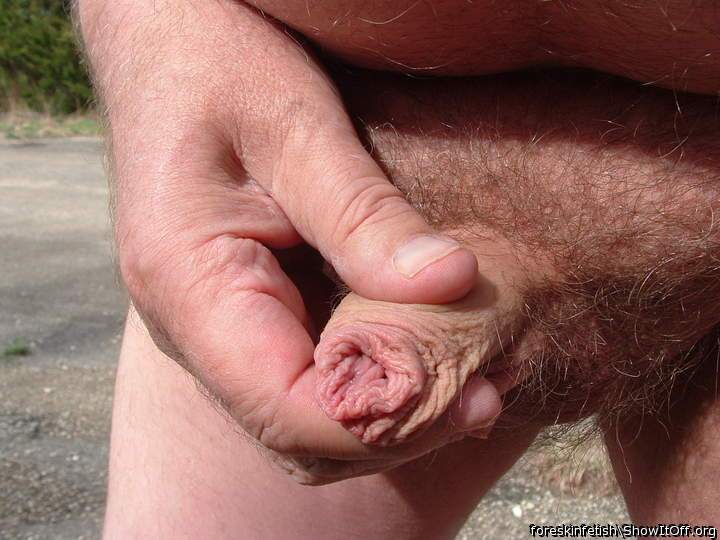 Photo of a third leg from foreskinfetish