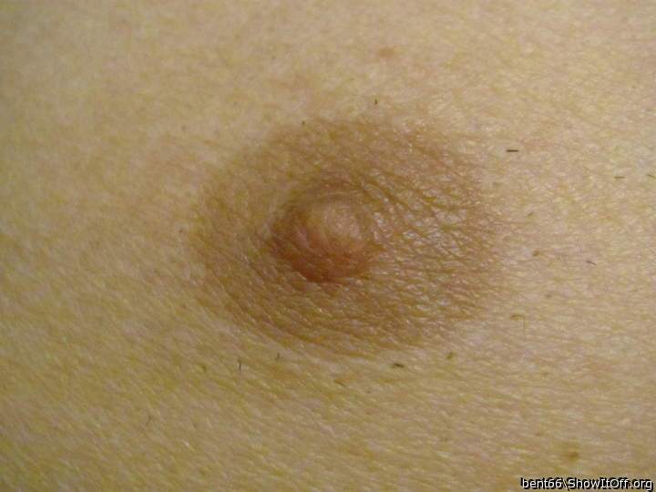 Right nipple