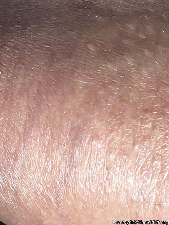 The texture of my foreskin