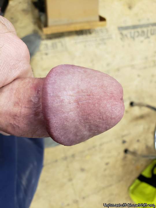 Photo of a penile from Mylimastuff