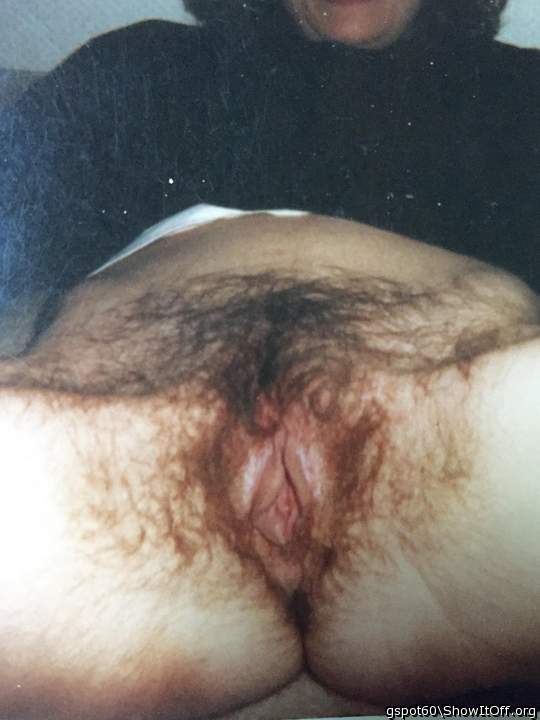 WOW!! Great coverage and distribution of pubic hair