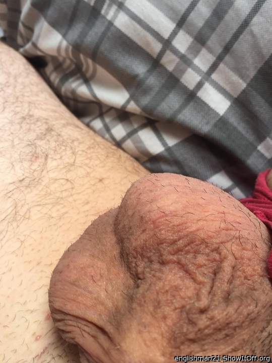 Testicles Photo from Englishman21
