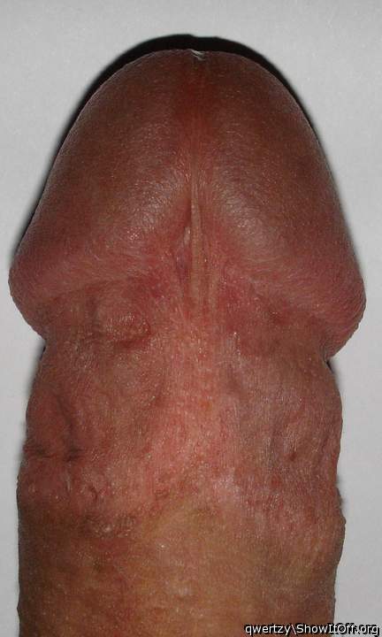 Photo of a third leg from qwertzy