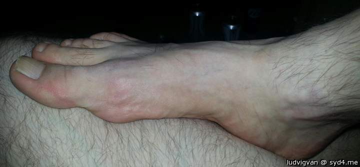 Like feet?