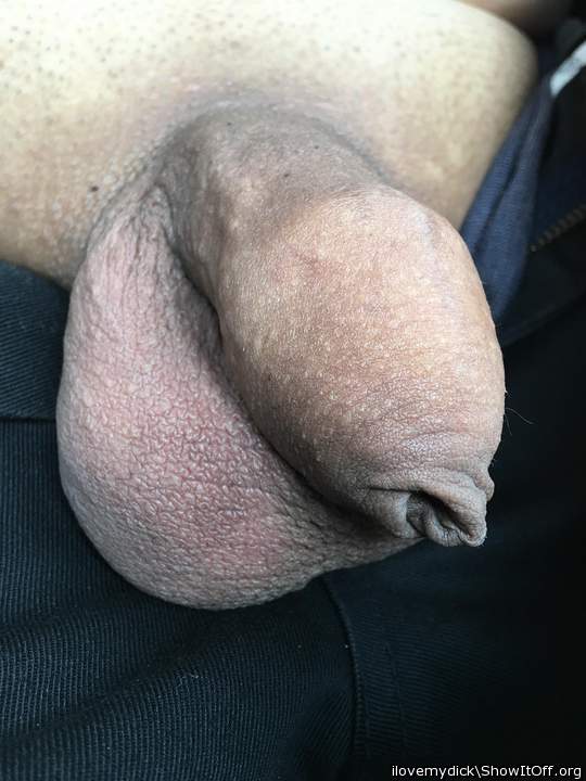 Photo of a penis from ilovemydick