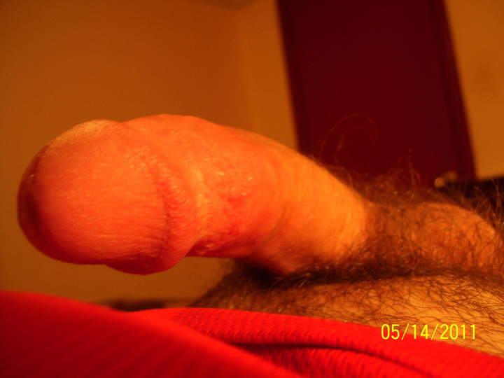 Photo of a penile from JUSTTOPLAY75