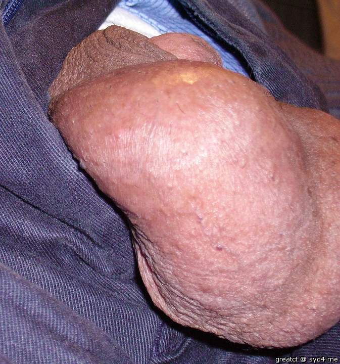 Testicles Photo from greatct