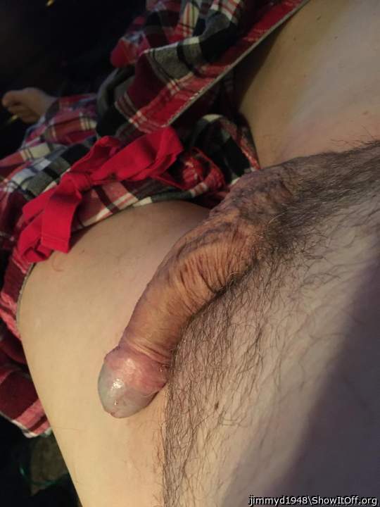 Photo of a penile from jimmyd1948
