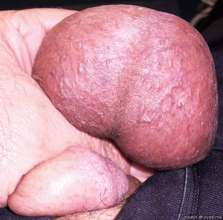 Testicles Photo from greatct