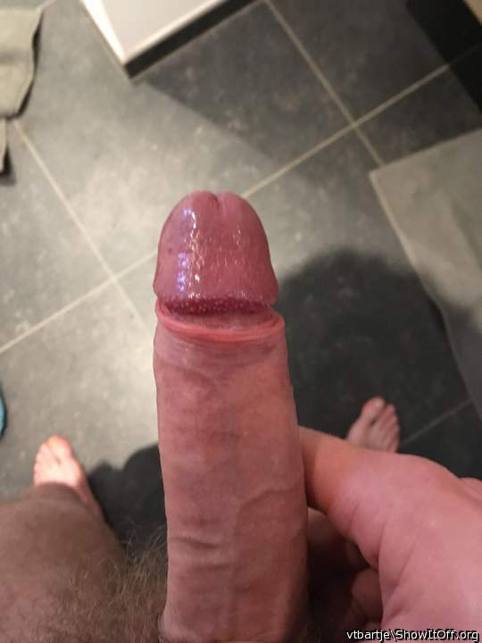 Photo of a penile from vtbartje