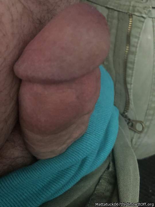 Photo of a penile from Mattatuck06705