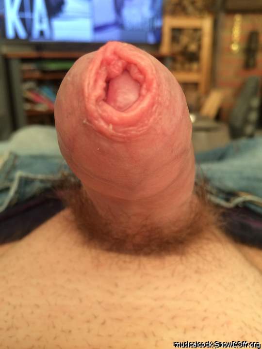 that foreskin needs a tongue and spit in it (or pussy juice)