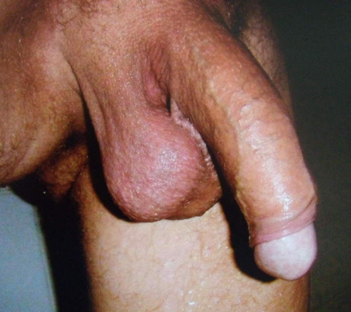 Photo of a phallus from oliver09