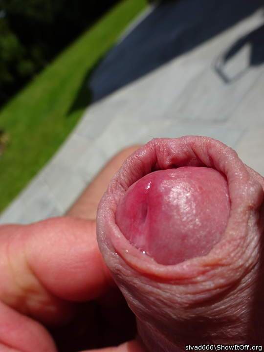 Photo of a penile from sivad666