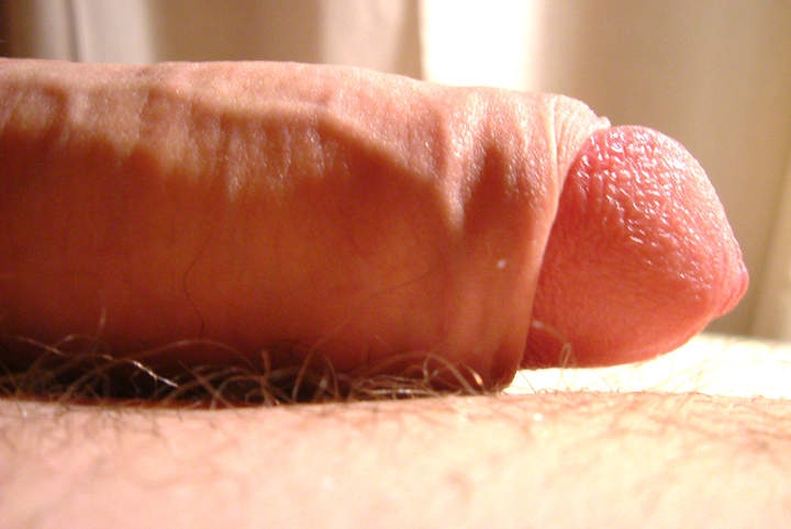 Photo of a penile from recordslave