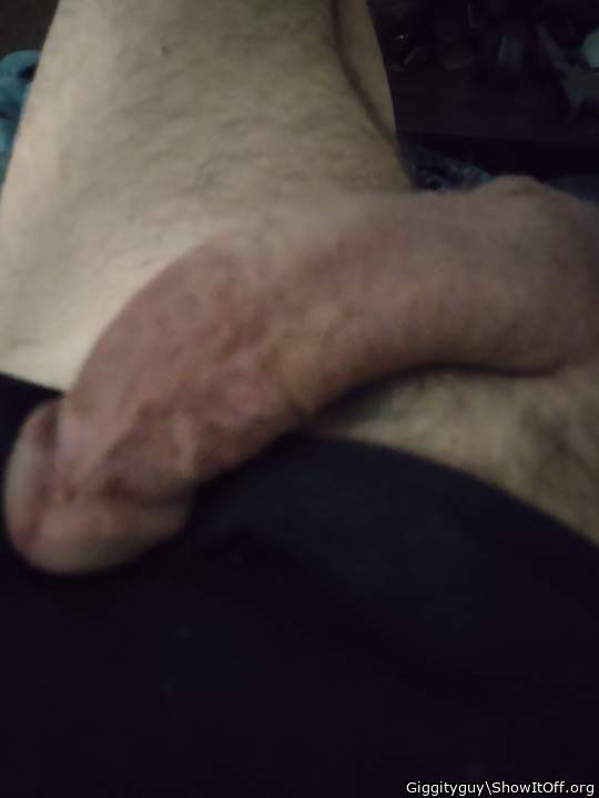 Photo of a middle leg from Giggityguy