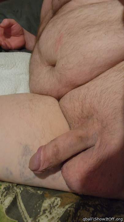 Photo of a penile from qball