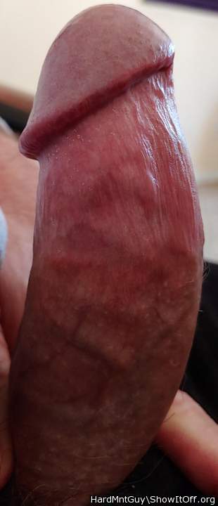Photo of a penile from HardMntGuy