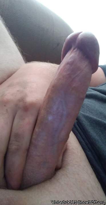 Photo of a penile from Whitedick381