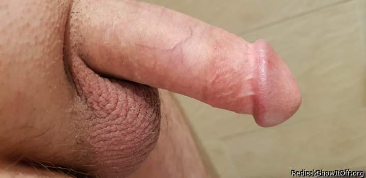Photo of a penile from Rediss