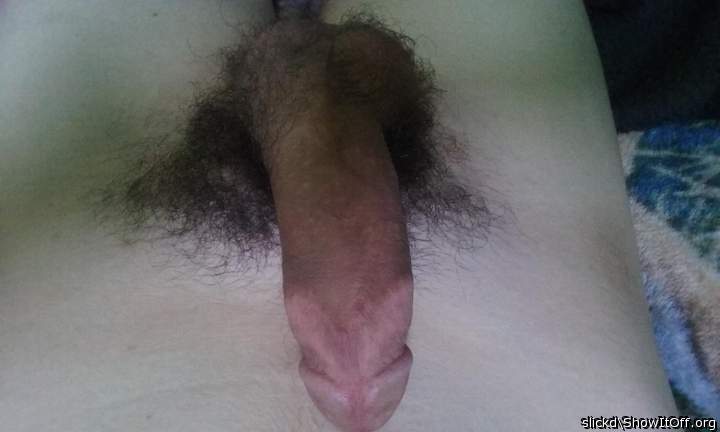 Photo of a penile from slickd