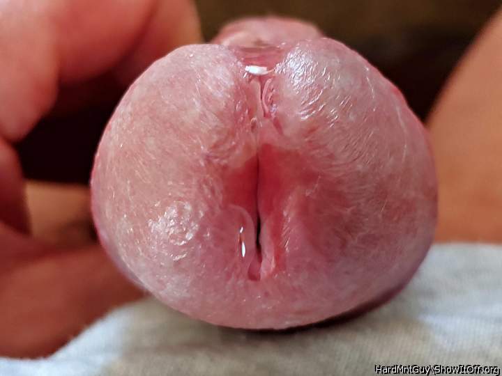 Photo of a penile from HardMntGuy