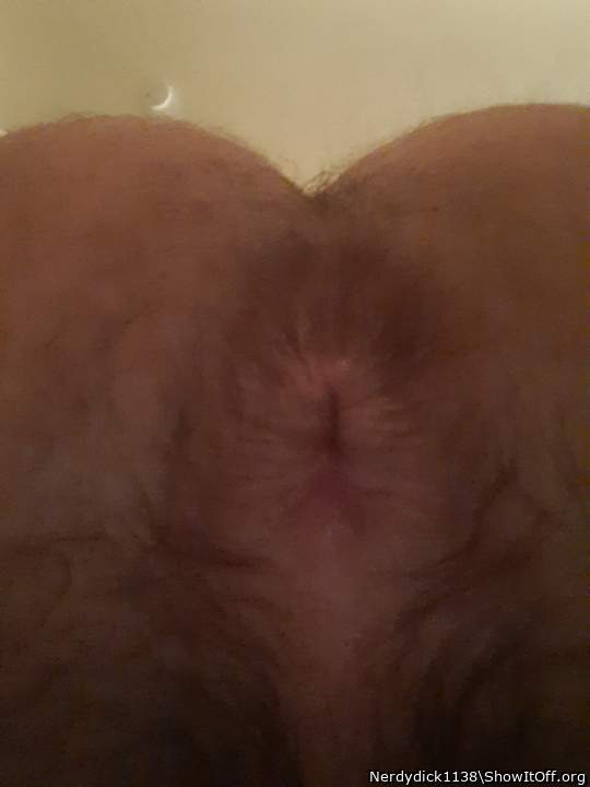 My anus after an insertion of a shaving cream can.
