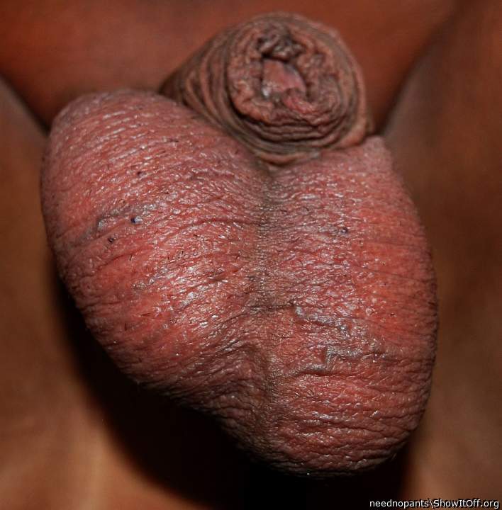 Testicles Photo from neednopants