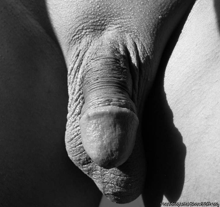 Photo of a penile from neednopants