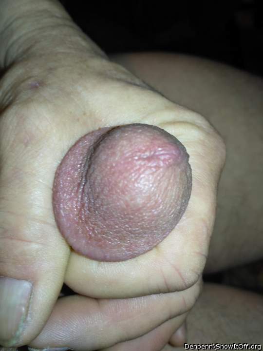 Photo of a penile from Denpenn