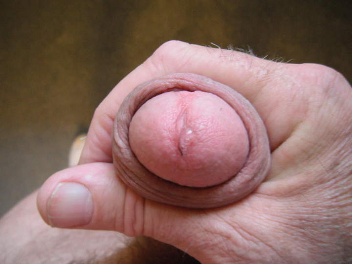 Photo of a penis from brewsky47