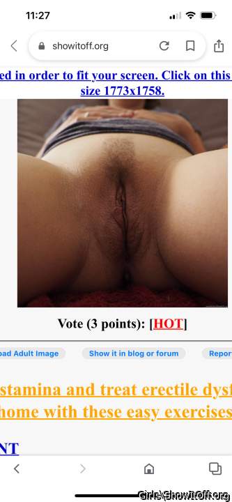 Photo of lower lips from Girls