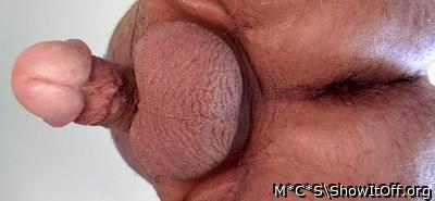 Photo of a penile from M*C*S