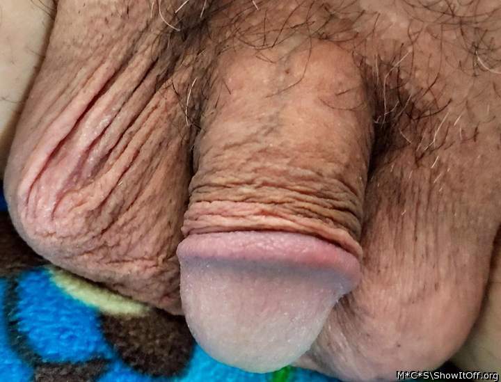 Photo of a penile from M*C*S