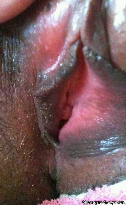 Photo of lower lips from BALLZDIXNCLITZ