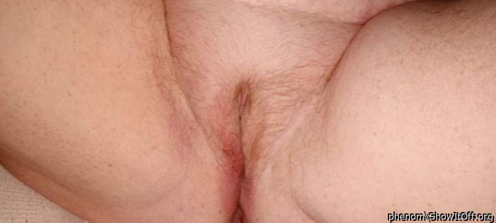 Photo of flaps from phenom