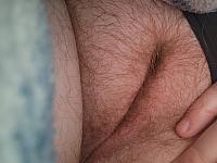 photo of crotch